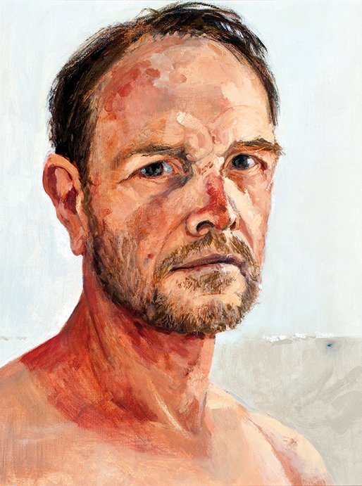 Self Portrait with sun damage, 2014 by Andrew Sayers.