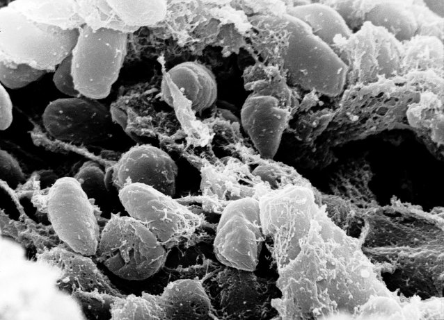 Yersinia pestis bacteria in an infected flea